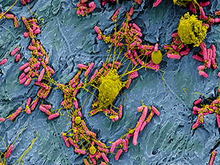 Large, amorphous yellow blobs with long, stringy, tendril-like extensions, trap a group of smaller, rod-shaped bacteria dispersed across the bladder cells of a mouse.