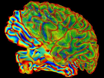 Side view of a computer-generated multi-color image of the human brain.